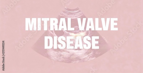 Mitral Valve Disease, an ultrasound image of the heart highlighting cardiac issues and health awareness.