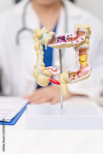 Foto Doctor with human Colon anatomy model