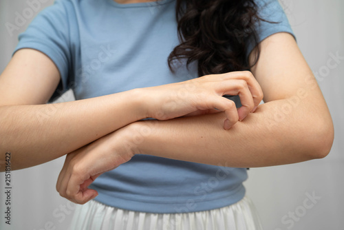 Photography Asian woman itching of skin diseases using hand scratching.