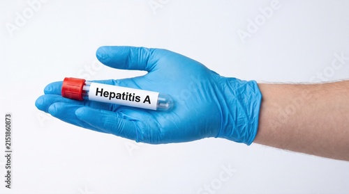 Hand in blue glove holding a medical test tube labeled Hepatitis A