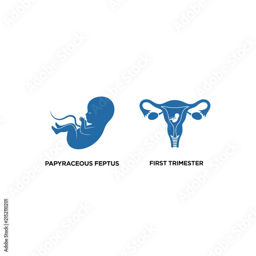 Fetal development and first trimester uterine pregnancy icons