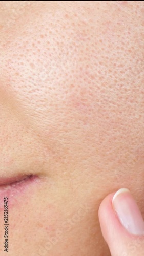 Close-up of woman examining facial skin with fingers. Visible pores and skin texture highlight dermatology, skin health, facial examination and concerns about skin condition