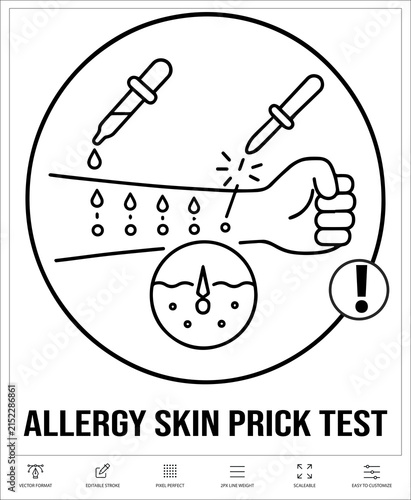 Foto Allergy Skin Prick Test