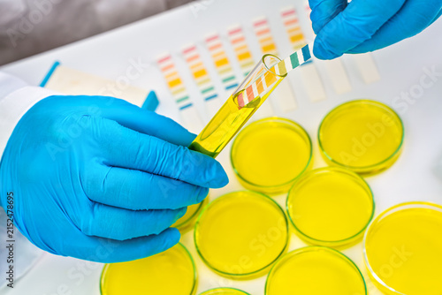 Lab scientist measuring PH with test stripes of a liquid in a tube sample, more petri dish near, closeup detail