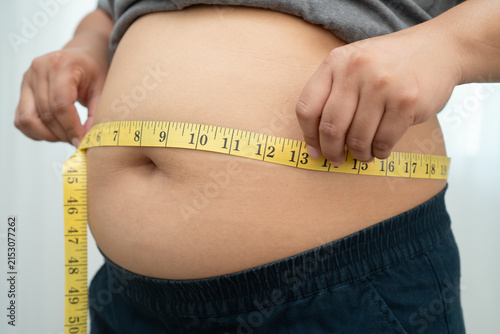 Obraz na plátně Asian woman with fat belly big size overweight and obesity with measure tape