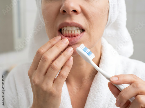 Woman in white bathrobe examining red bleeding gums during dental hygiene routine in bright bathroom setting.