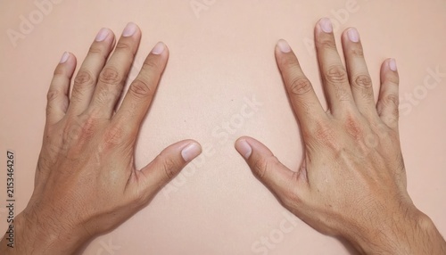Two male hands resting on beige skin tone background.