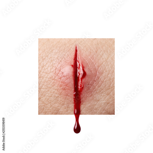 Realistic open wound skin laceration with dripping blood