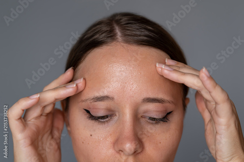 Young woman touching shiny forehead, oily skin with small breakouts and forehead acne, skincare concern and hormonal skin changes concept on gray background