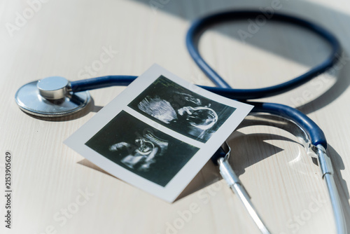 Canvastavla Photo: Ultrasound screening of a child and stethoscope