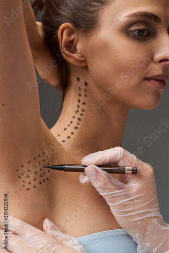 Fotografía Doctor hands in sterile gloves drawing grid with pen on female armpit