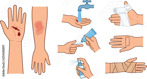 First Aid and Wound Care Icon Set with Hand Injury, Cut, Burn, Washing under Faucet, Applying Ointment, Spraying Antiseptic, Bandage, and Patch Dressing Vector