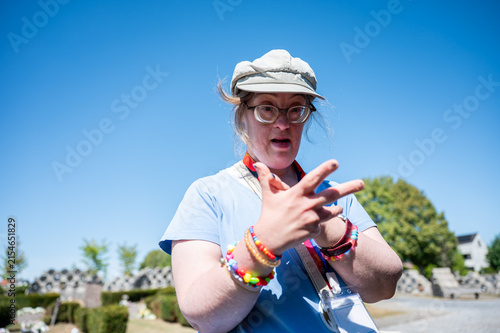 43-year-old woman with Down syndrome counting on her fingers