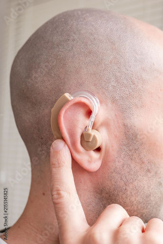 Young man with beige hearing aid in ear, close up portrait, BTE hearing support, accessibility, modern technology, inclusion, health care, confidence and everyday life, Modern healthcare solutions