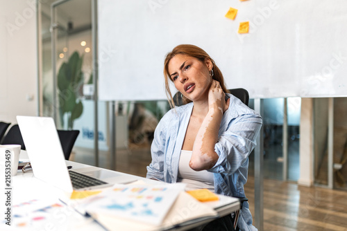 Neck pain. Upper body discomfort, Office worker with muscle strain, Healthcare and ergonomics concept. Stressed woman sitting at desk and holding painful neck with hand in modern workplace.