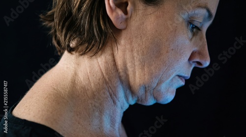 Side profile close up of mature woman neck and jawline showing skin aging and sagging neck wrinkles