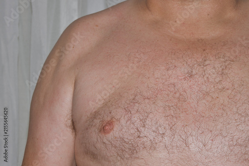 older man with chest fat and obesity