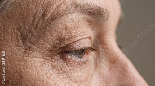 Macro side profile of senior eye with deep crow feet wrinkles and sagging eyelid skin