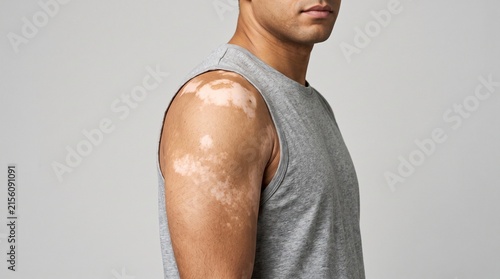 Man in sleeveless shirt showing arm muscle definition.