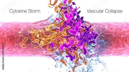 Cytokine storm and vascular collapse medical illustration of inflammation