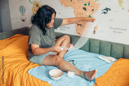 Young woman sitting on bed while changing bandage on her injured leg at home. Medical supplies, gauze, scissors, and home care items illustrate wound treatment, first aid, rehabilitation