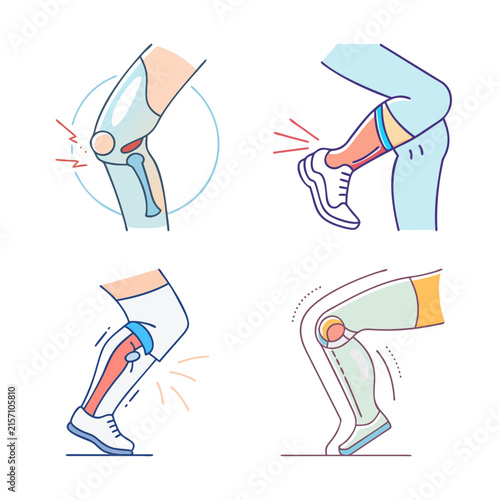 Human knee joint movement illustration - Clear vector illustration showing knee joint bending and locking in different positions for medical or educational use.