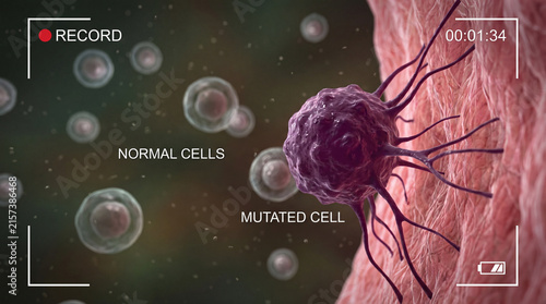 Photography Microscopic view showing mutated cancerous cell invading surrounding healthy