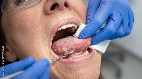 Dentist Performing Oral Cancer Screening Examination for Early Detection