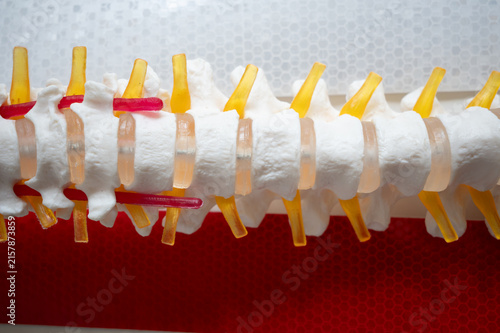 Lumbar spine anatomical model showing vertebrae, discs and spinal nerves