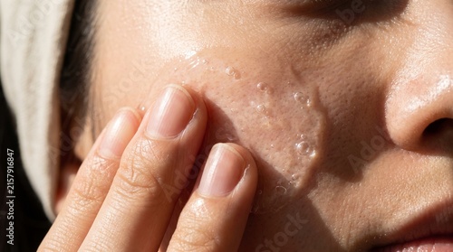 Macro Fingertip Patting Gel Essence Across Hydrated Korean Cheek