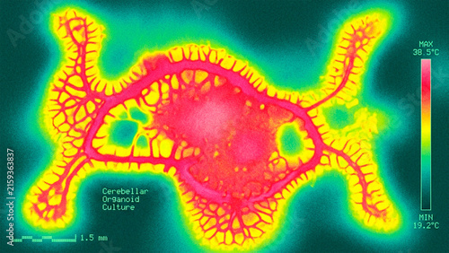 Canvas Print Grainy Thermal Map Background with Cerebellar Organoid Culture and Heatmap Scale