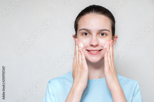A smiling beautiful girl's face in acne uses a foaming cleanser. Teenage skin care concept, copy space