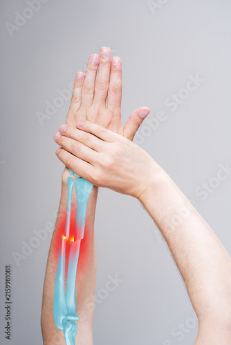 Fracture with displaced of radius and ulna, broken arm, pain in his hand, painful area highlighted in red with illustration anatomical bones