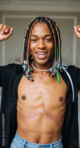 Smiling young black man with colorful braids and visible chest scar posing with arms raised wearing open shirt indoors
