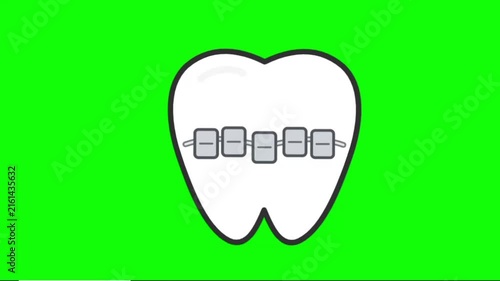 Animated Tooth Braces Icon on Green Screen – Orthodontic Dental Concept