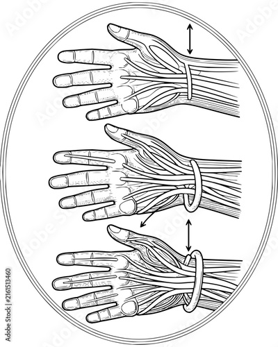 Medical illustration of human hand tendons and ligaments showing biomechanical movement