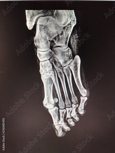 Fotografie Dislocation