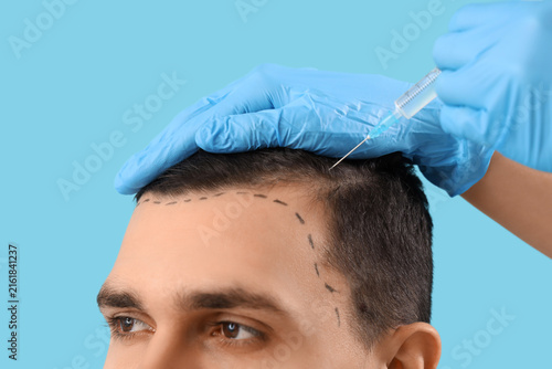 Foto Young man with marks receiving injection for hair growth on blue background, clo
