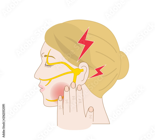 Profile Illustration of a white woman with Trigeminal Neuralgia Feeling Facial Pain