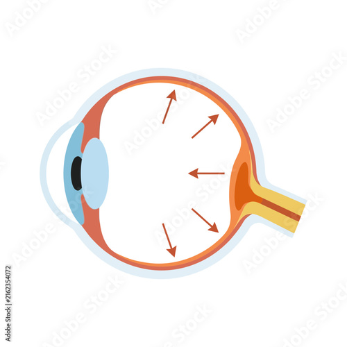 Anatomical cross section diagram of a human eye showing intraocular pressure with directional arrows
