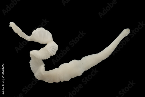 Scientific collection of freshwater trematode parasites, including Clinostomum spp., Postorchigenes sp., and Thapariella sp. These parasitic flatworms have complex life cycles involving multiple hosts