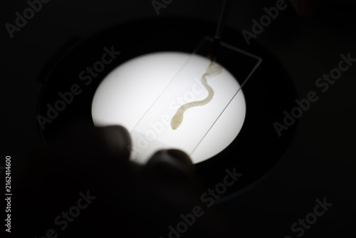 Scientific collection of freshwater trematode parasites, including Clinostomum spp., Postorchigenes sp., and Thapariella sp. These parasitic flatworms have complex life cycles involving multiple hosts