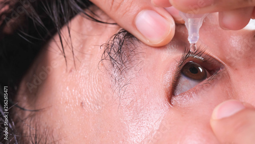 Close up of Asian man suffer from eyes pain and using eye drops or artificial tears to prevent dryness, Macro of eye