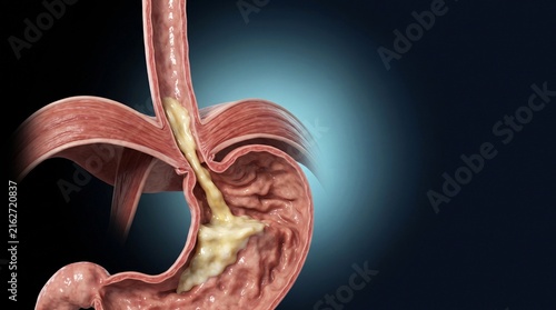 Cross-sectional view of human stomach with food bolus and gastric juices during digestion process.