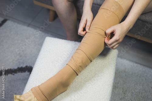 Woman pulling up and adjusting a beige medical compression stocking on her leg. Close up.