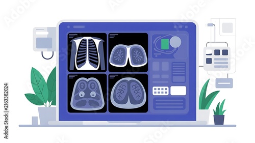 Medical lung scan on computer screen, digital radiology diagnostic imaging illustration.