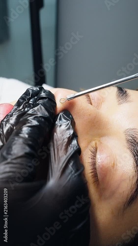 Cosmetologist extracting blackheads from patient's nose skin