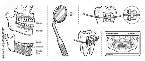 Dental Anatomy and Orthodontic Treatment Illustration