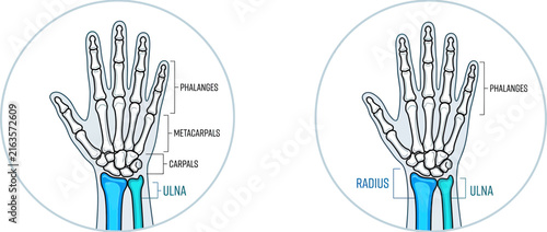 Canvastavla Human Hand Skeleton Anatomy Diagram