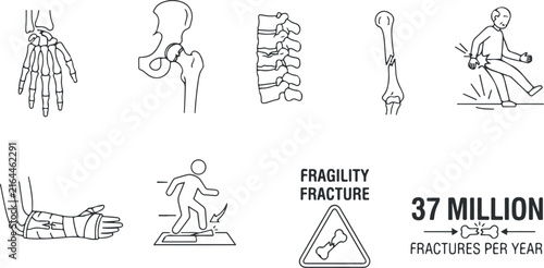 Human skeleton parts and fracture illustrations showing hand, hip, spine, broken bone, and falling injury.
